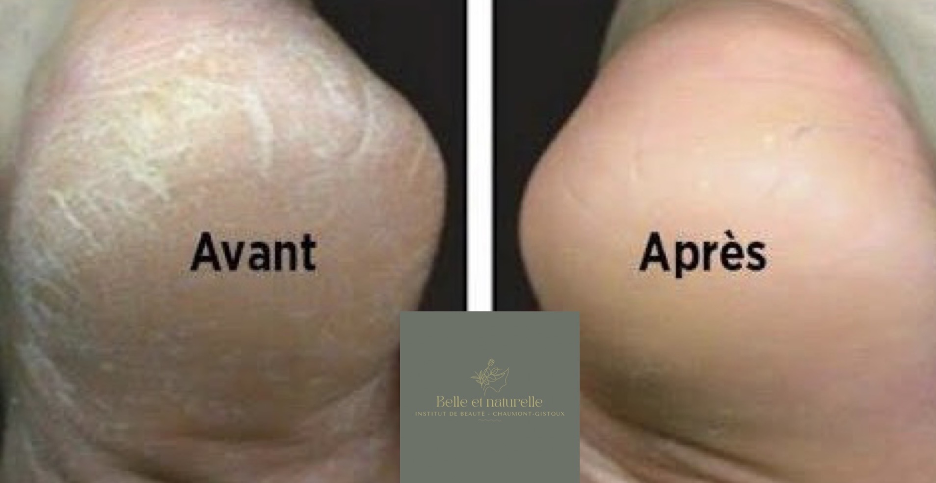 Avant et après une pédicure spa à l’institut Belle et Naturelle : pieds hydratés, peau lisse et ongles soignés grâce à des soins naturels et relaxants.